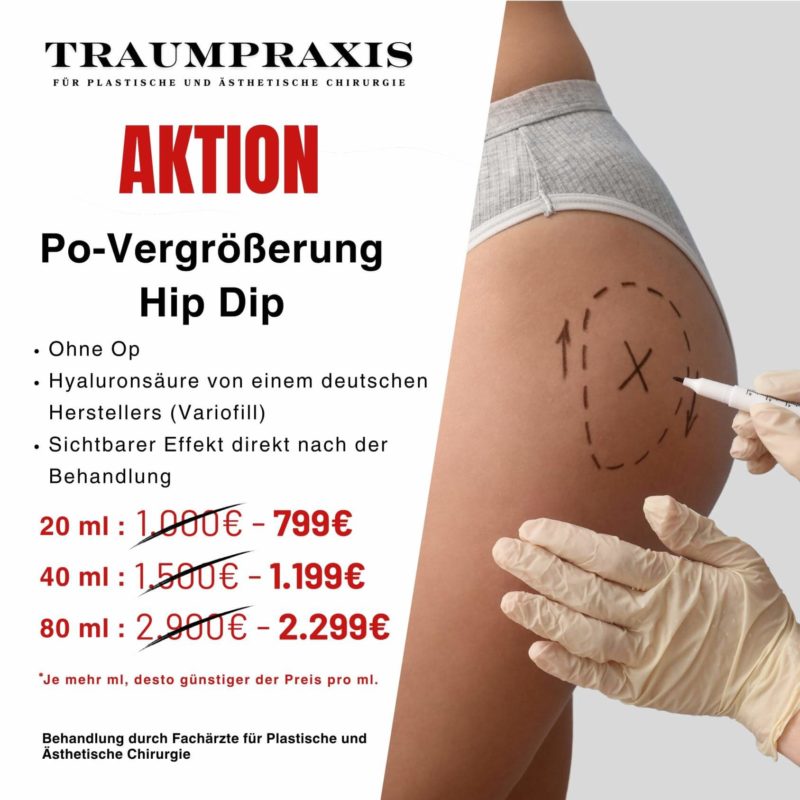 PO-Vergrößerung-Aktion